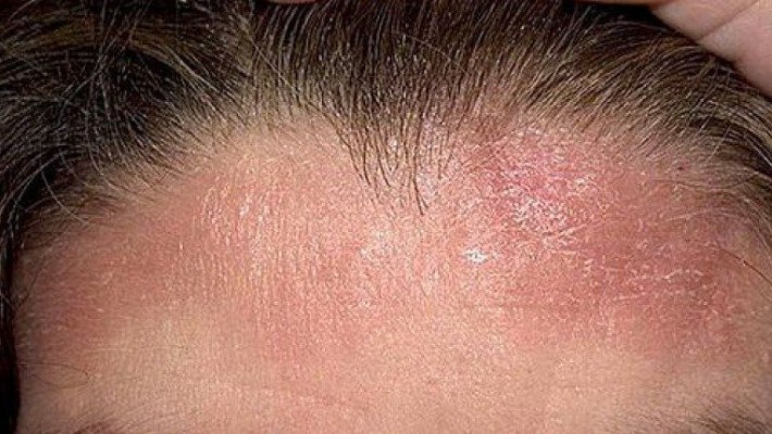 Шкоду лазні або сауни – причини не ходити часто туди