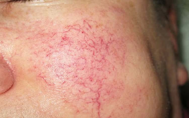 Шкоду лазні або сауни – причини не ходити часто туди