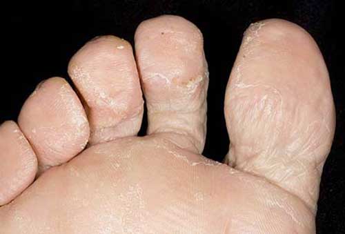 Шкоду лазні або сауни – причини не ходити часто туди