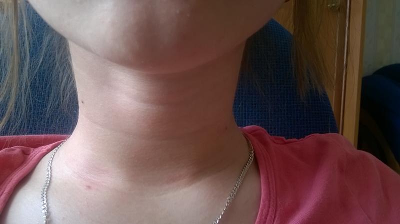 Смартфон створює проблеми здоров’ю шкіри . Як саме? – відповіді вчених